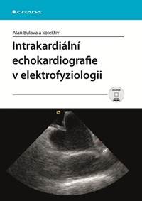 Intrakardiální echokardiografie v elektrofyziologii + DVD