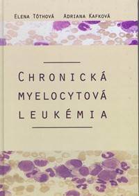 Chronická myelocytová leukémia kúpite na Knihyprekazdeho.sk