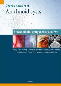 Arachnoid cysts - Arachnoidální cysty mozku a míchy