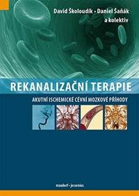 Kniha Rekanalizační terapie - Akutní ischemické cévní mozkové příhody