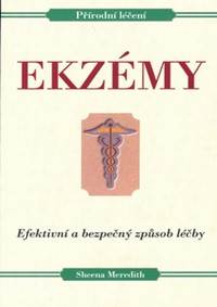 Ekzémy