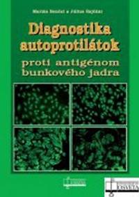 Diagnostika autoprotilátok proti antigénom bunkového jadra kúpite na Knihyprekazdeho.sk