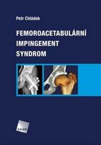 Femoroacetabulární impingement syndrom kúpite na Knihyprekazdeho.sk