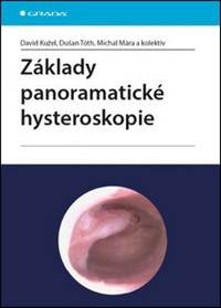 Základy panoramatické hysteroskopie