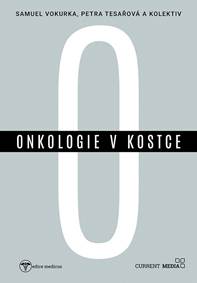 Onkologie v kostce