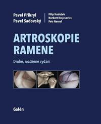 Artroskopie ramene kúpite na Knihyprekazdeho.sk