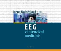 EEG v intenzivní medicíně kúpite na Knihyprekazdeho.sk