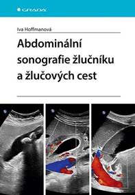 Abdominální sonografie žlučníku a žlučových cest kúpite na Knihyprekazdeho.sk