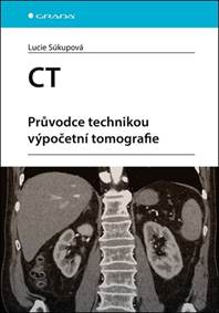 CT - Průvodce technikou výpočetní tomografie kúpite na Knihyprekazdeho.sk