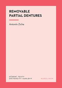 Removable Partial Dentures
