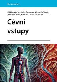 Cévní vstupy kúpite na Knihyprekazdeho.sk