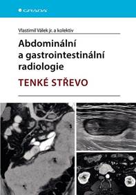 Abdominální a gastrointestinální radiologie kúpite na Knihyprekazdeho.sk