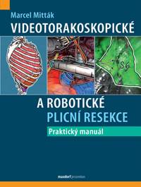 Kniha Videotorakoskopické a robotické plicní resekce