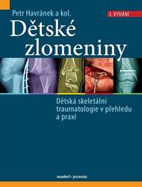 Dětské zlomeniny