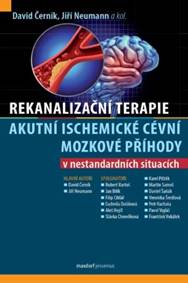 Rekanalizační terapie akutní ischemické cévní mozkové příhody v nestandardních situacích - Jiří Neumann, David Černík